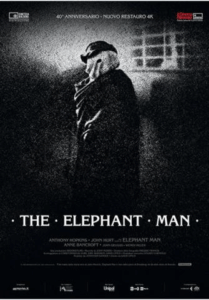 The Elephant Man